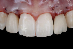 lembi e suture dr rossi garda 2026