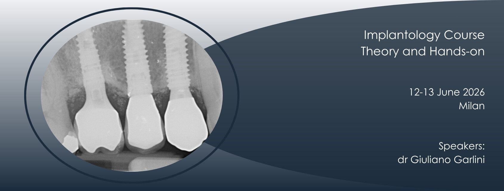 Corso Implantologia Milano 12-13 giugno 2026 dr Garlini